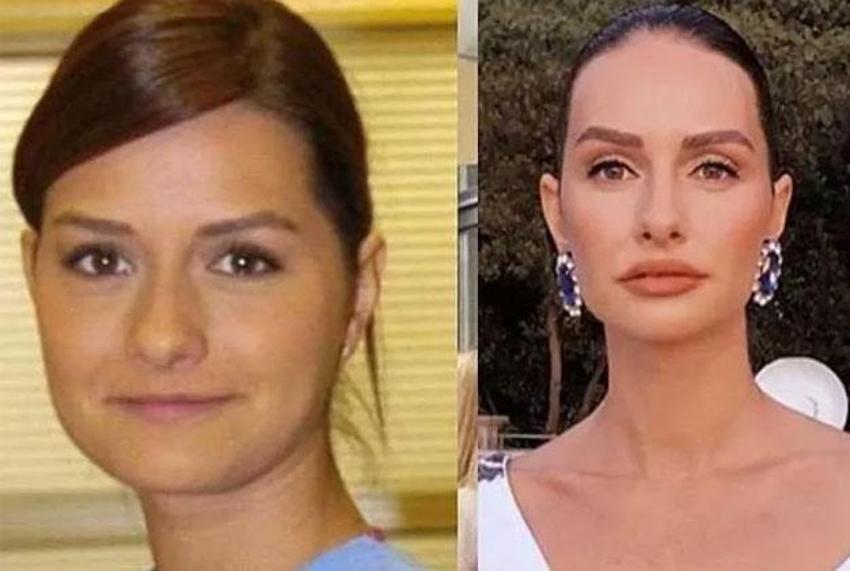 Büşra Pekin'den dikkat çeken açıklama: Kendi doğallığımı bozmayı düşünmüyorum