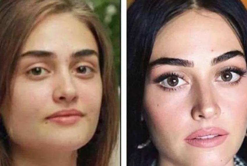 Büşra Pekin'den dikkat çeken açıklama: Kendi doğallığımı bozmayı düşünmüyorum