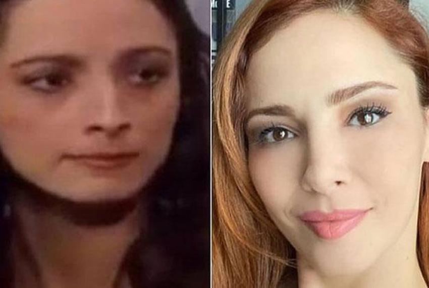 Büşra Pekin'den dikkat çeken açıklama: Kendi doğallığımı bozmayı düşünmüyorum