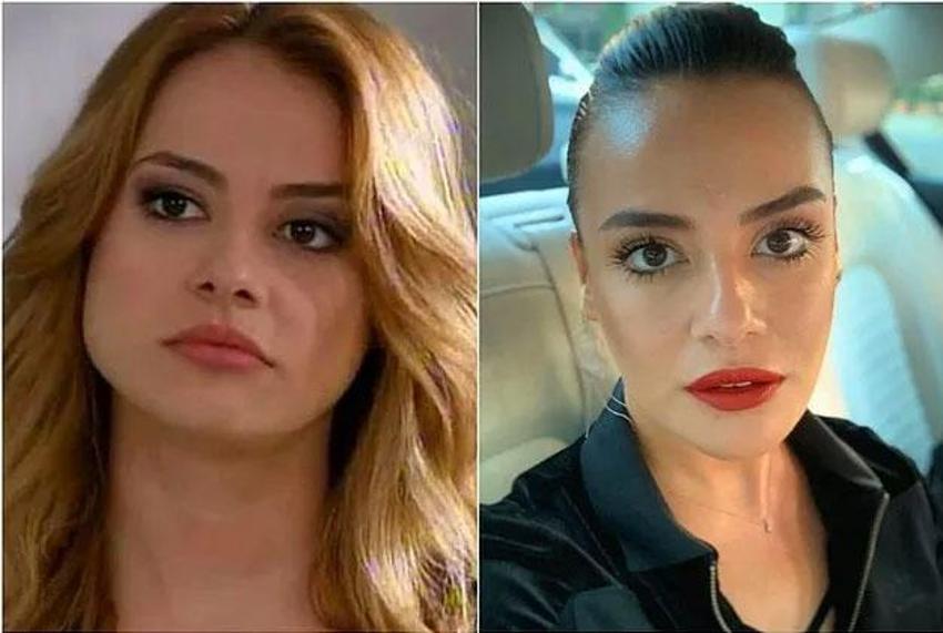 Büşra Pekin'den dikkat çeken açıklama: Kendi doğallığımı bozmayı düşünmüyorum