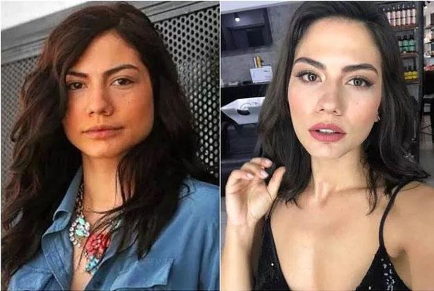 Büşra Pekin'den dikkat çeken açıklama: Kendi doğallığımı bozmayı düşünmüyorum