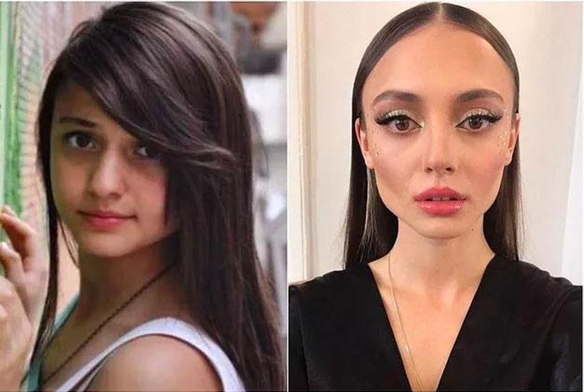 Büşra Pekin'den dikkat çeken açıklama: Kendi doğallığımı bozmayı düşünmüyorum