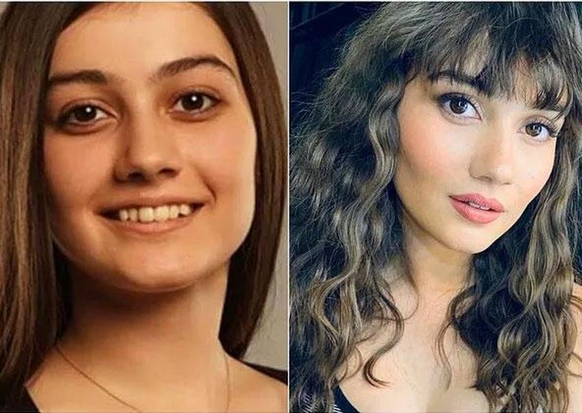 Büşra Pekin'den dikkat çeken açıklama: Kendi doğallığımı bozmayı düşünmüyorum