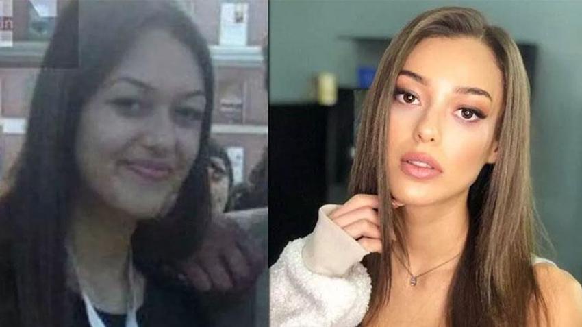 Büşra Pekin'den dikkat çeken açıklama: Kendi doğallığımı bozmayı düşünmüyorum