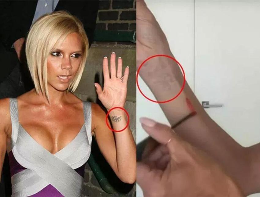 Victoria Beckham'dan dikkat çeken estetik itirafı!