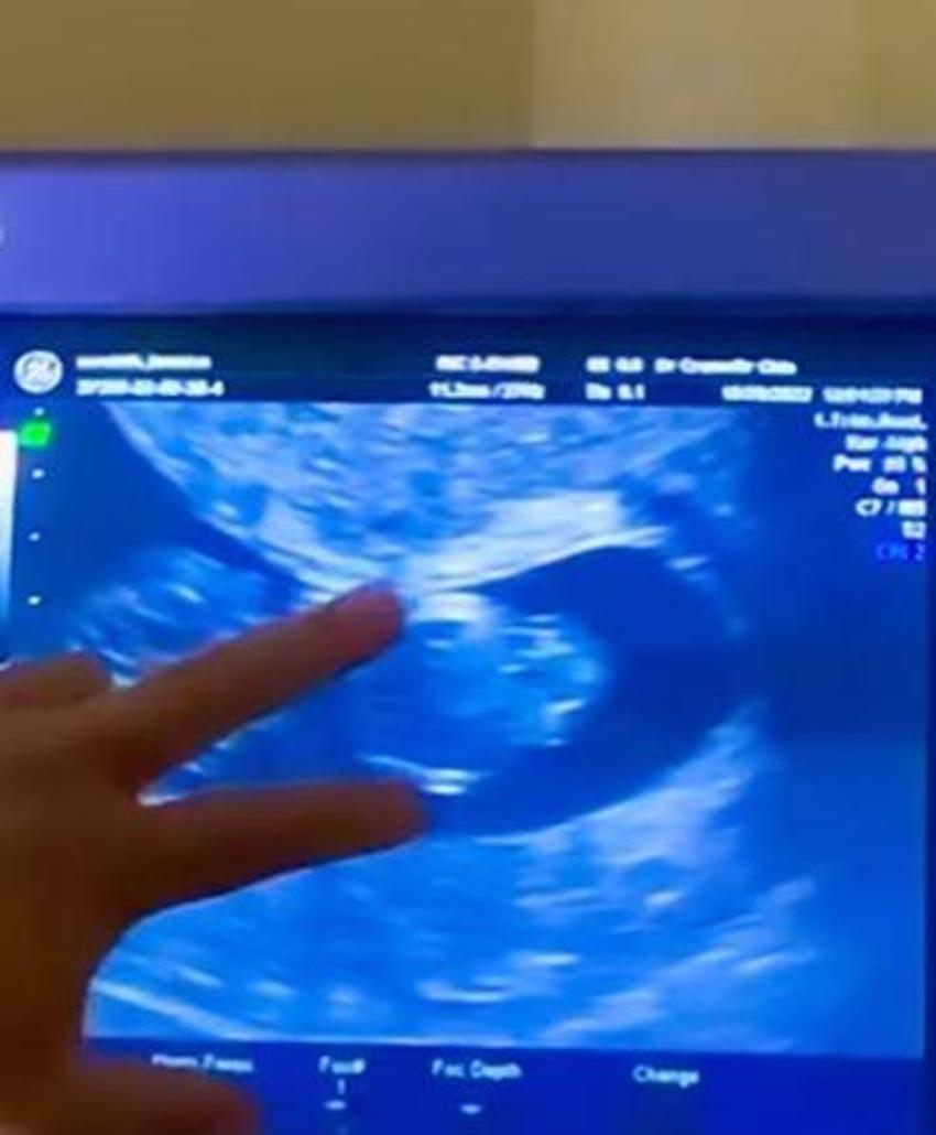 13 ay önce bebeğini kaybetmişti! Dünyaca ünlü yıldız yeniden hamile