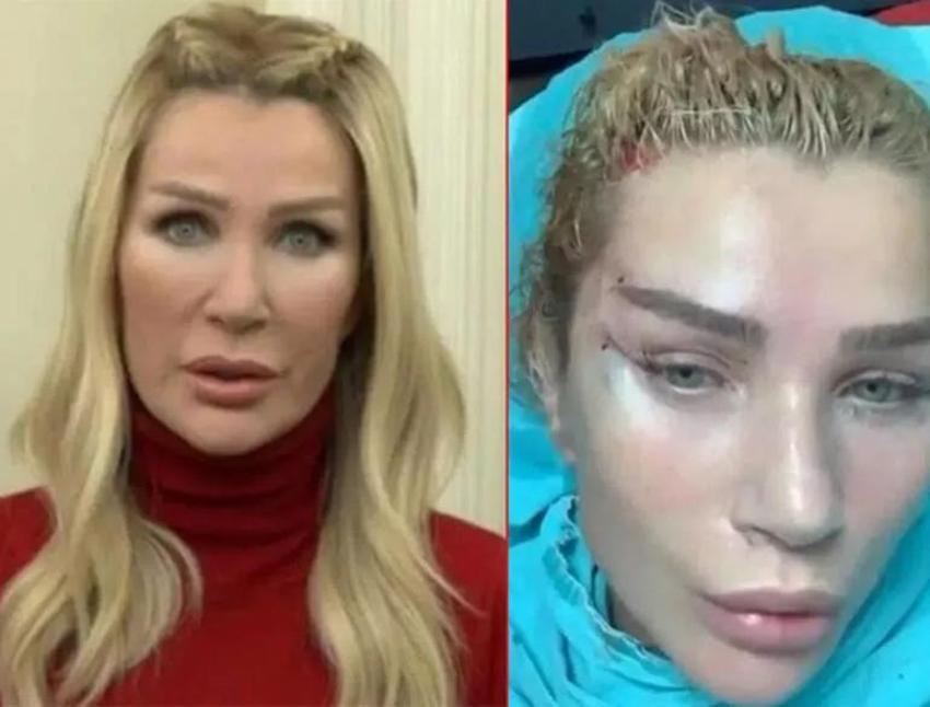 Günel Zeynalova değişimiyle şaşırtıyor! 'Ufak dokunuşlar yaptım'