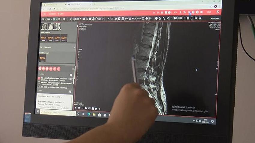 Dünyada bir ilk! Türk hekimleri buldu, 40'lı yaşlarda başlıyor