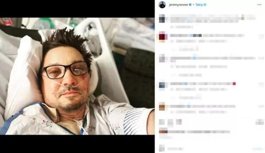 Jeremy Renner, kar küreme aracının altında kalmıştı! Arkadaşları sağlık durumunu açıkladı
