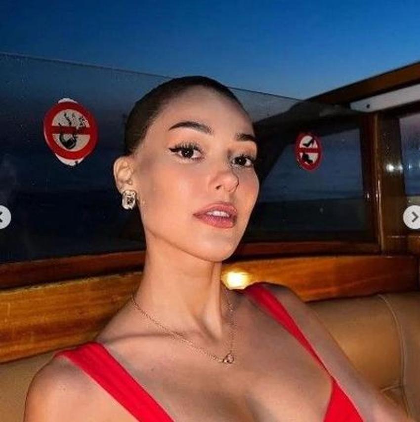 Dilan Çiçek Deniz estetiksiz haliyle gündemde! 
