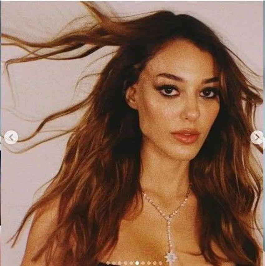 Dilan Çiçek Deniz estetiksiz haliyle gündemde! 