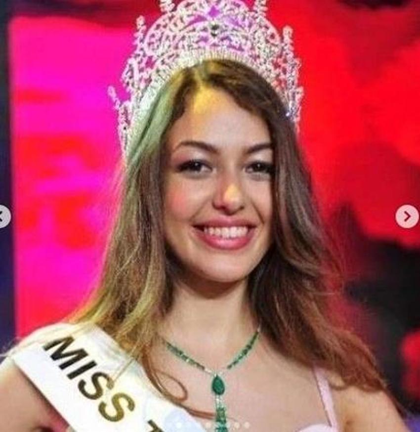 Dilan Çiçek Deniz estetiksiz haliyle gündemde! 