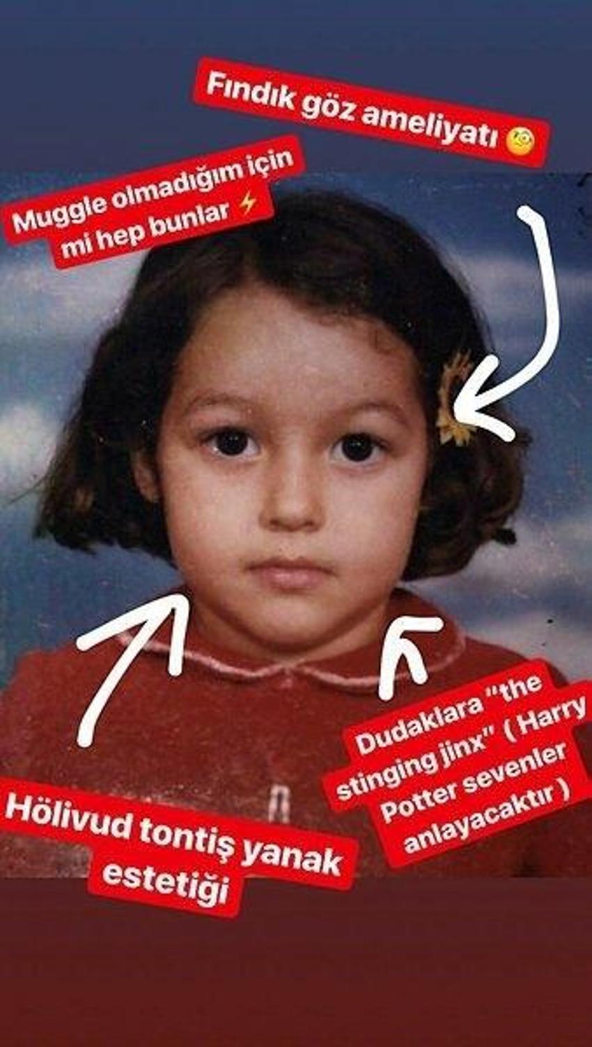 Dilan Çiçek Deniz estetiksiz haliyle gündemde! 