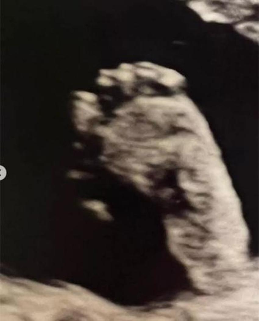 Geniş Aile'nin yıldızı Bora Akkaş baba oluyor! Eşi böyle duyurdu