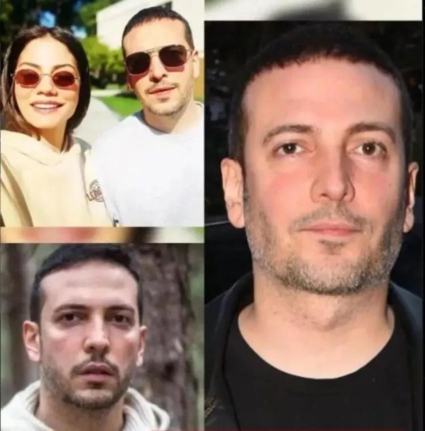Oğuzhan Koç estetik yaptırdı! İşte son hali