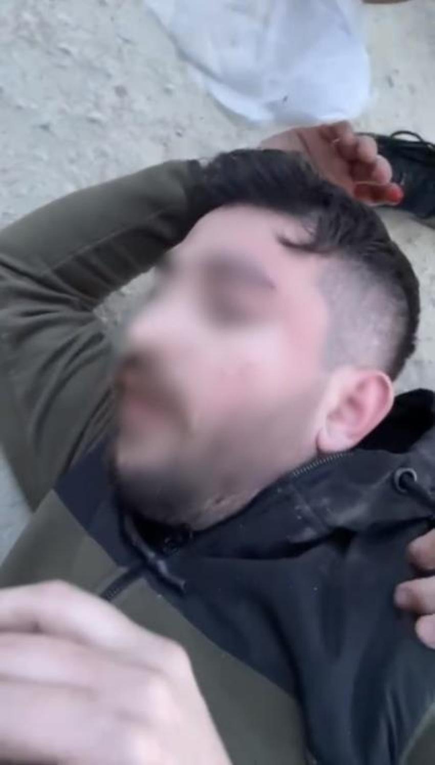 İstanbul’da baltalı oduncu dehşeti! Başına odunla vurulan genç felç kaldı