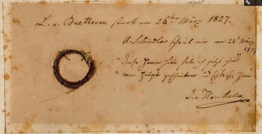 Beethoven’ı ölüme götüren hastalığın sırrını 200 yıllık saç telleri çözdü!