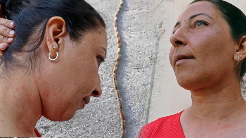 Evinin bahçesindeki tırtılları süpürdü, panikle hastaneye gitti! 'Her şey 15 dakika içinde oldu'