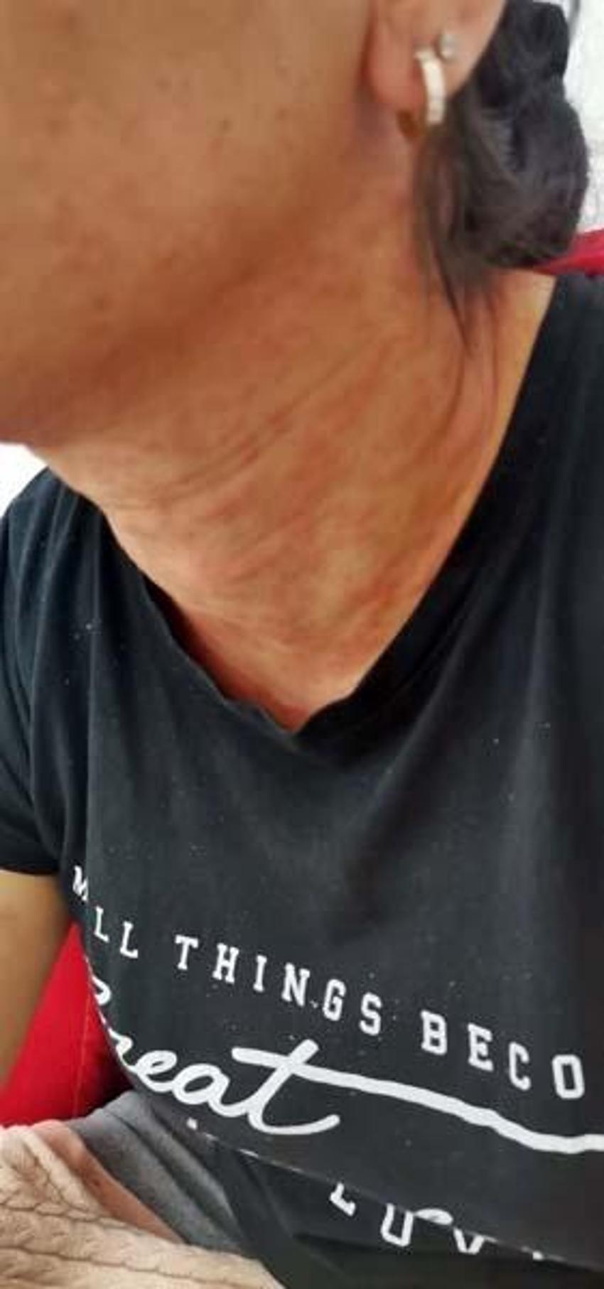 Evinin bahçesindeki tırtılları süpürdü, panikle hastaneye gitti! 'Her şey 15 dakika içinde oldu'