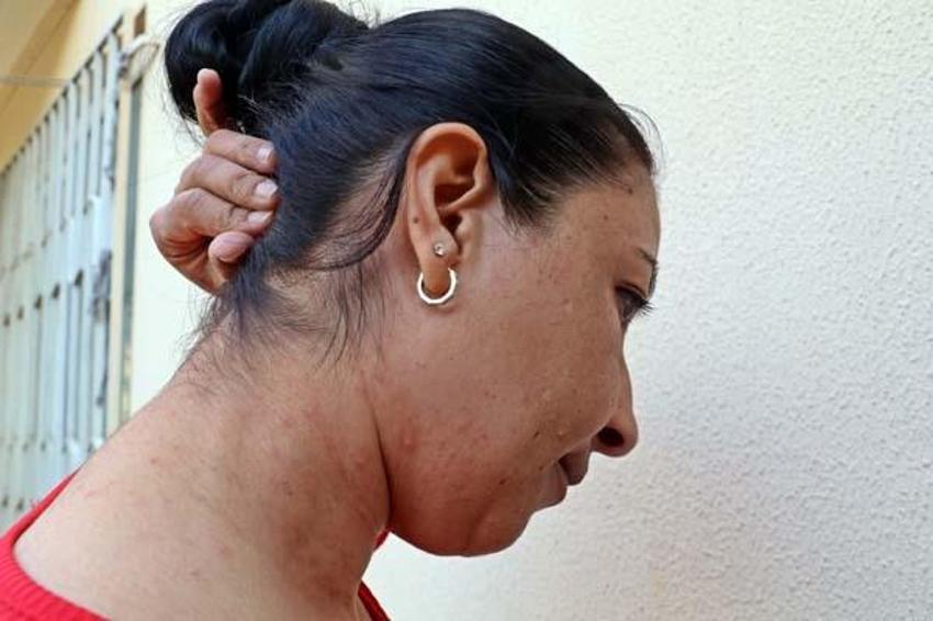 Evinin bahçesindeki tırtılları süpürdü, panikle hastaneye gitti! 'Her şey 15 dakika içinde oldu'