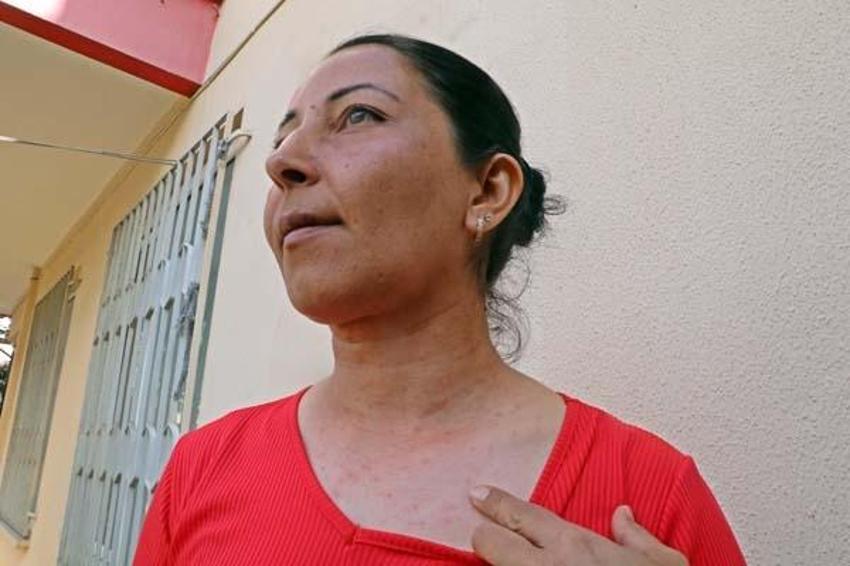 Evinin bahçesindeki tırtılları süpürdü, panikle hastaneye gitti! 'Her şey 15 dakika içinde oldu'