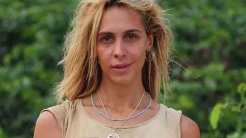 Survivor yarışmacısı Duygu Bal'ın son halini gören inanamıyor!
