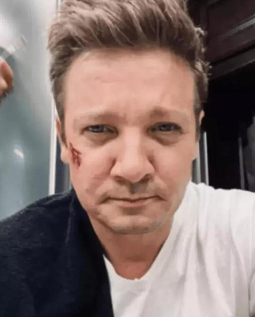 Kar küreme aracının altında kalmıştı! Jeremy Renner'ın sağlık durumu iyiye gidiyor