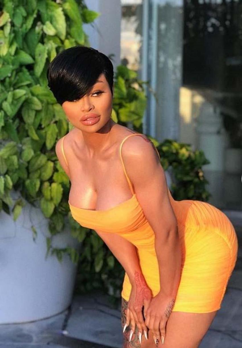 Blac Chyna'dan şoke eden açıklama: Kalça enjeksiyonu yüzünden ölümün kıyısından döndüm