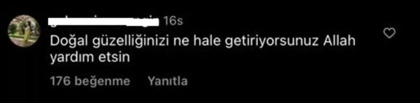 Özge Ulusoy'un son hali gündem oldu! 'Hiç iyi görünmüyorsunuz'
