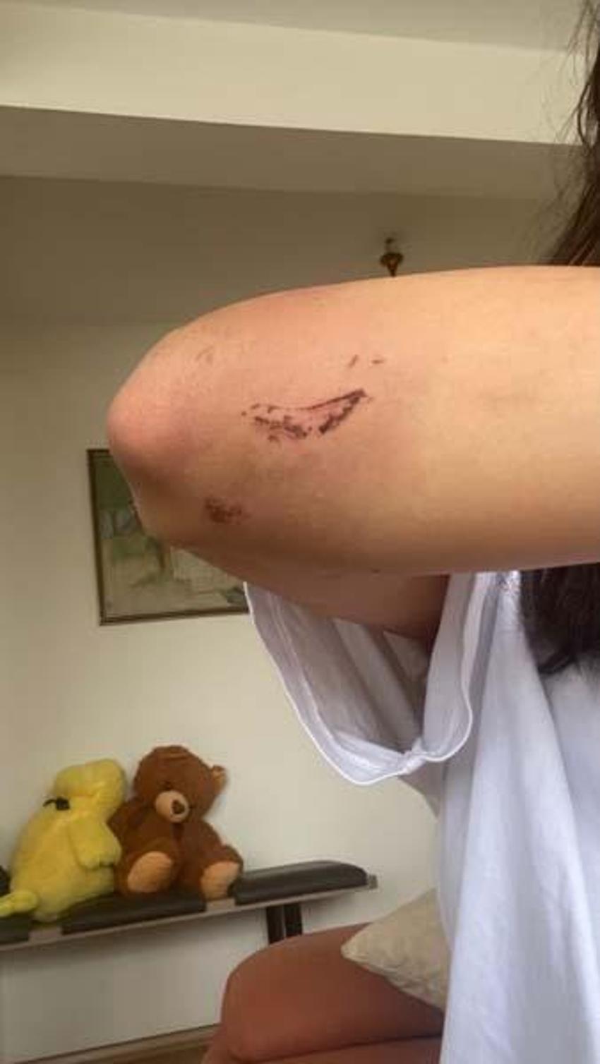 İstanbul’da öldüresiye dövülen kız kardeşlerden “basit yaralama” tepkisi: “Ölmemiz mi gerekiyor?”