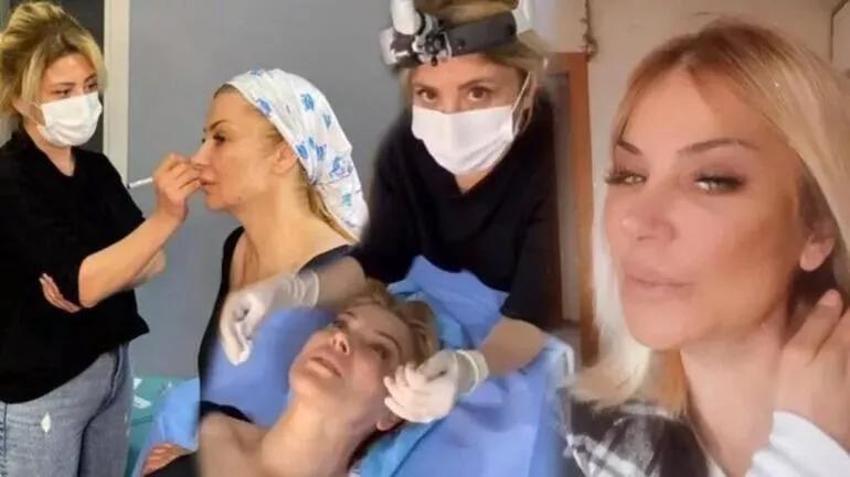 Songül Karlı güzellik için yine bıçak altına yattı!