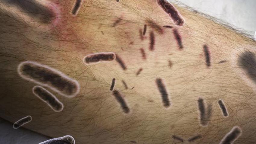 Sessiz pandemi "Lyme" 350 hastalığı taklit ediyor! 10 milyon kişide var
