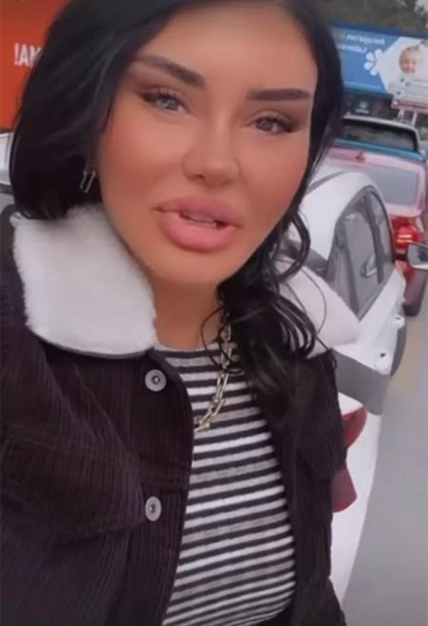 Estetikli ünlüler