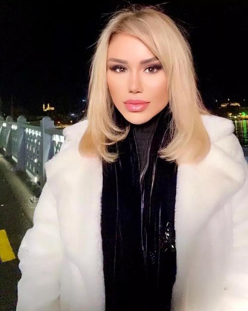 Ceylan estetiğin dozunu kaçırdı! 'Yüzünü hareket ettiremiyor'
