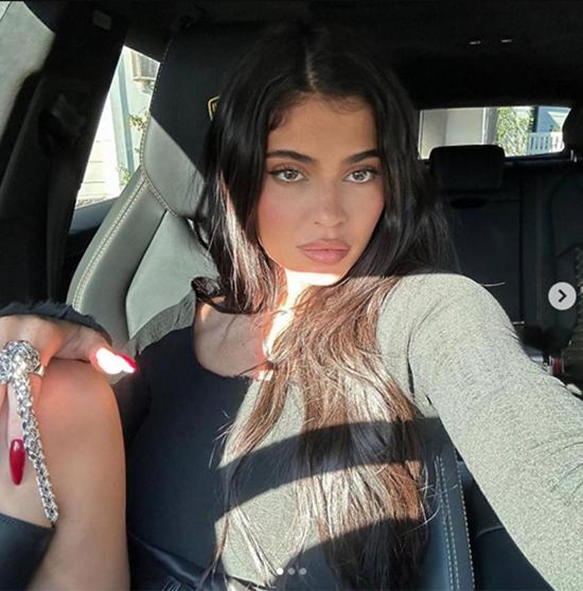 Kylie Jenner'den estetik itirafı: Yüzümün tamamı değil