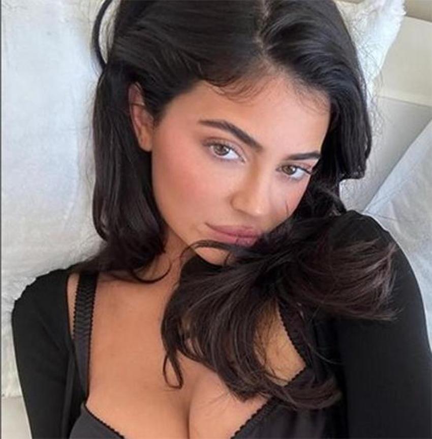 Kylie Jenner'den estetik itirafı: Yüzümün tamamı değil