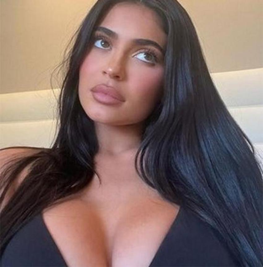 Kylie Jenner'den estetik itirafı: Yüzümün tamamı değil