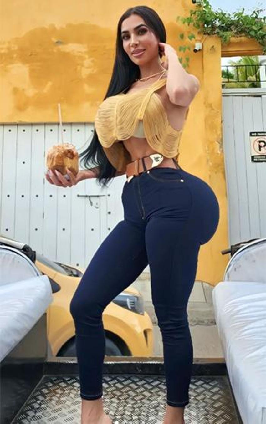 Kim Kardashian’a benzeyebilmek için yapmadığı estetik kalmadı! Sonu kötü bitti