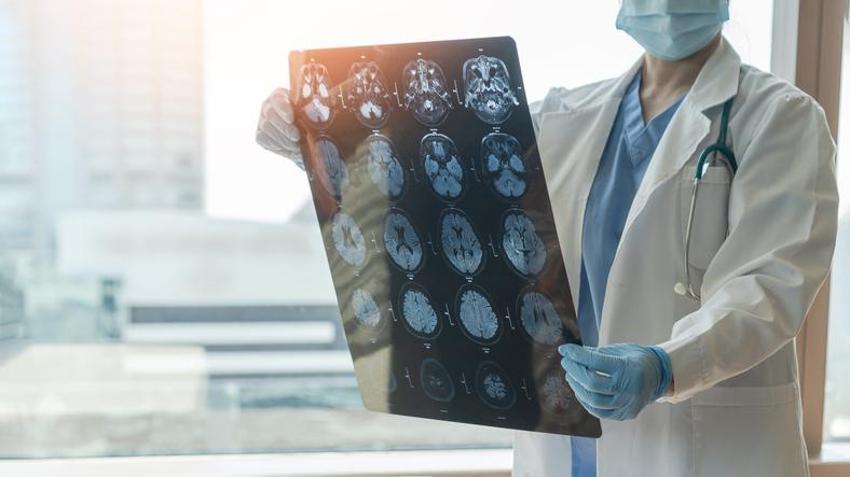 Alzheimer'ın ana sebebi! Bu alışkanlıklar hastalığı tetikliyor