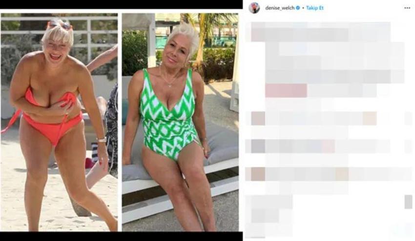 Alkolü bıraktıktan sonra 13 kilo aldı! 'Bir bağımlılığı başka bir bağımlılıkla değiştirdim'