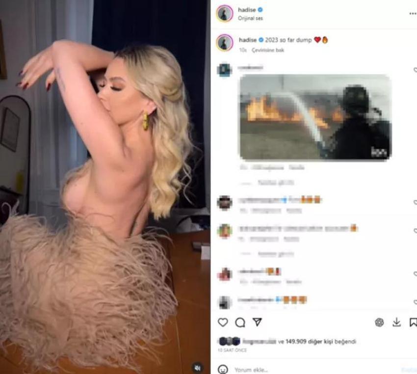 Hadise'den cesur paylaşım!
