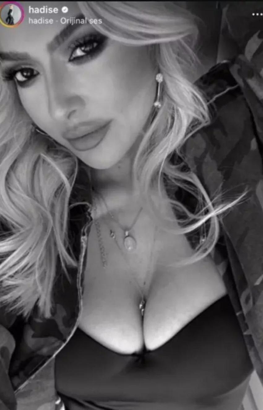 Hadise'den cesur paylaşım!