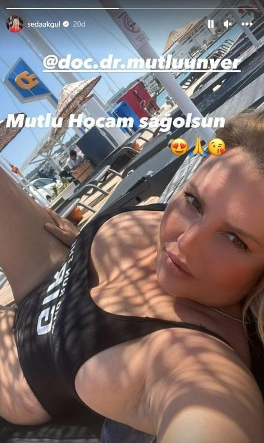 Seda Akgül mayolu pozlarını peş peşe paylaştı!