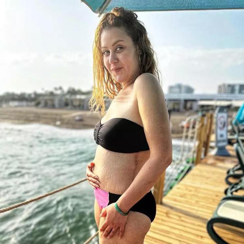 108 kilo veren Aslı Samat mayolu pozunu paylaştı! 'Göbeğimin iki hâli de gerçek'