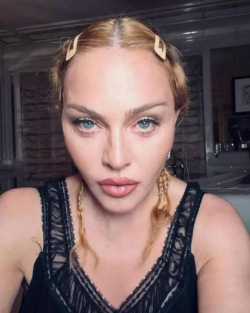 Madonna yoğun bakıma kaldırılmıştı! Hastaneden flaş açıklama geldi: İşte son durumu...