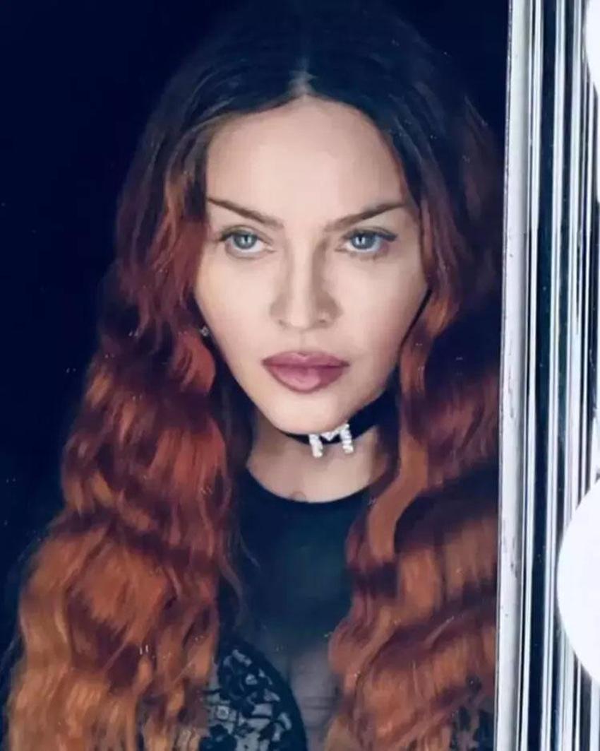 Madonna yoğun bakıma kaldırılmıştı! Hastaneden flaş açıklama geldi: İşte son durumu...