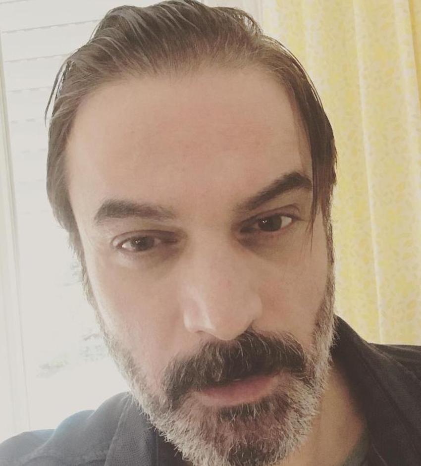 Ufuk Özkan siroza yakalandı! Hastalığı dolayısıyla bir anda eridi: İşte Ufuk Özkan'ın son hali