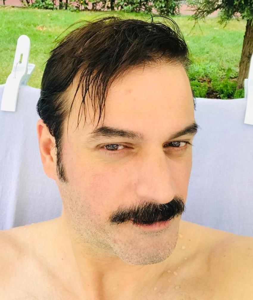 Ufuk Özkan siroza yakalandı! Hastalığı dolayısıyla bir anda eridi: İşte Ufuk Özkan'ın son hali