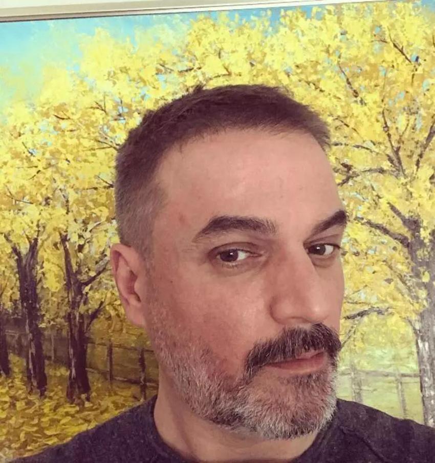 Ufuk Özkan organ nakli bekliyor! Doktorlar 1 yıl ömür biçmişti, sağlık durumunu açıkladı