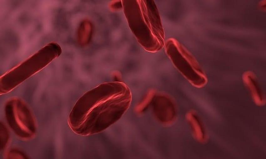 Tıkanmış damarları delip geçiyor! Unutulmuş tarif gün yüzüne çıktı